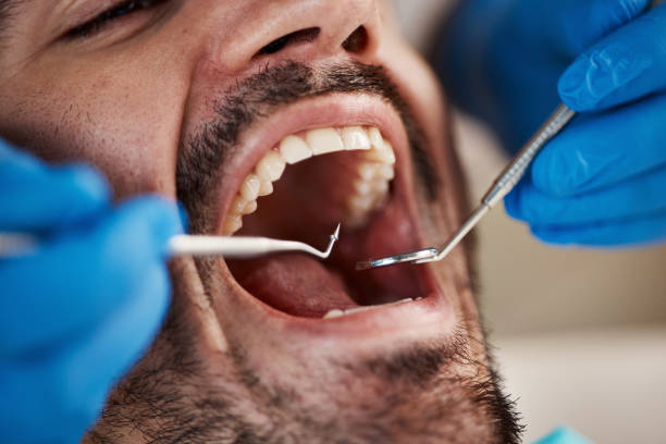 Best Root Canal Treatment  in Corsicana, TX